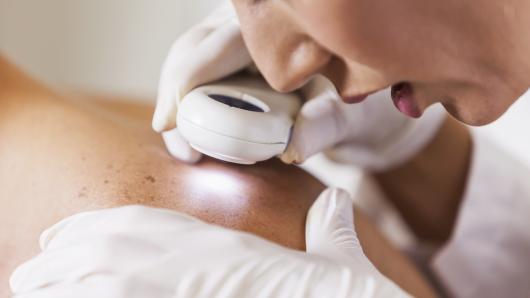 Skin Inflammation